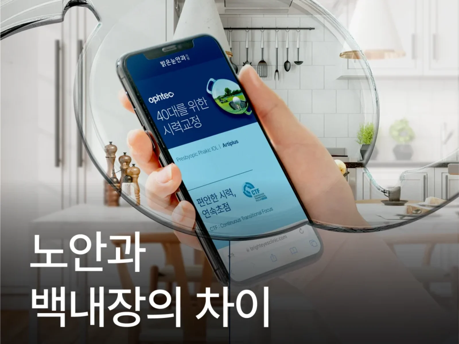 노안과 백내장 차이점